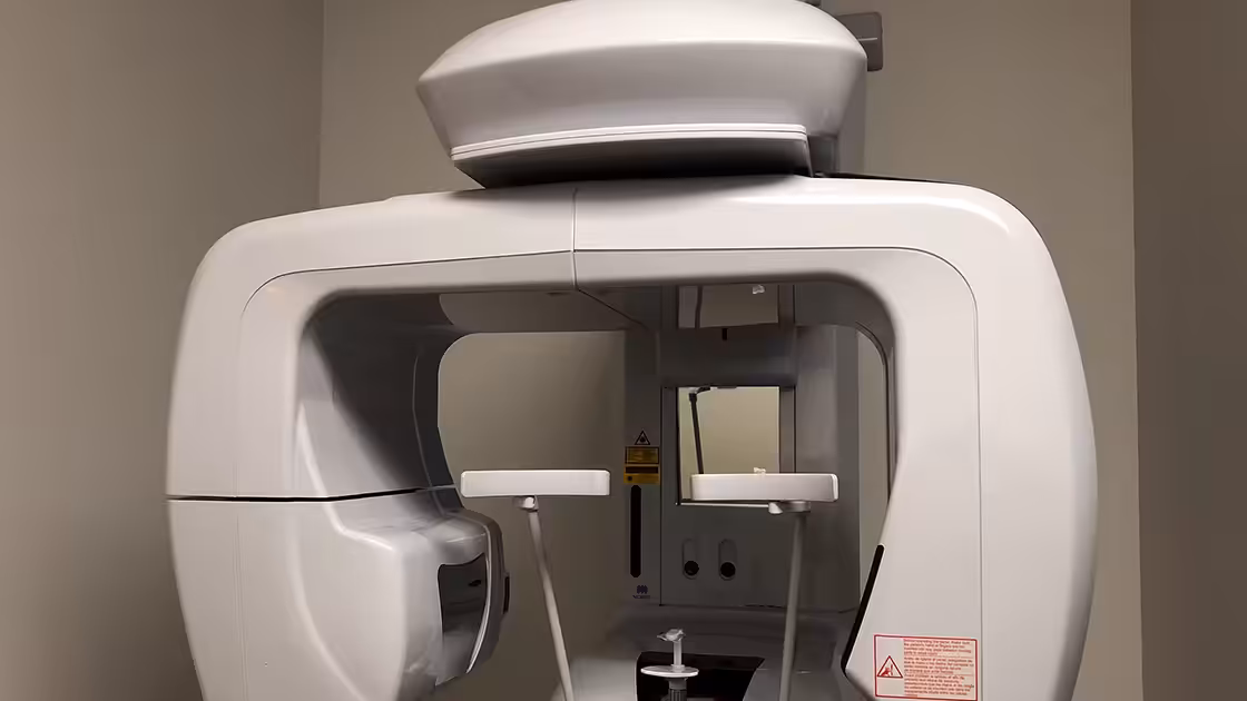 CBCT image